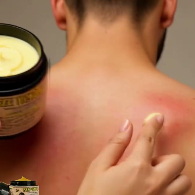 Crema de Veneno de Abeja ApiCalm para Articulaciones
